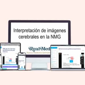 curso interpretación de imágenes cerebrales en la nmg