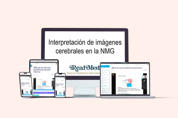 curso interpretación de imágenes cerebrales en la nmg